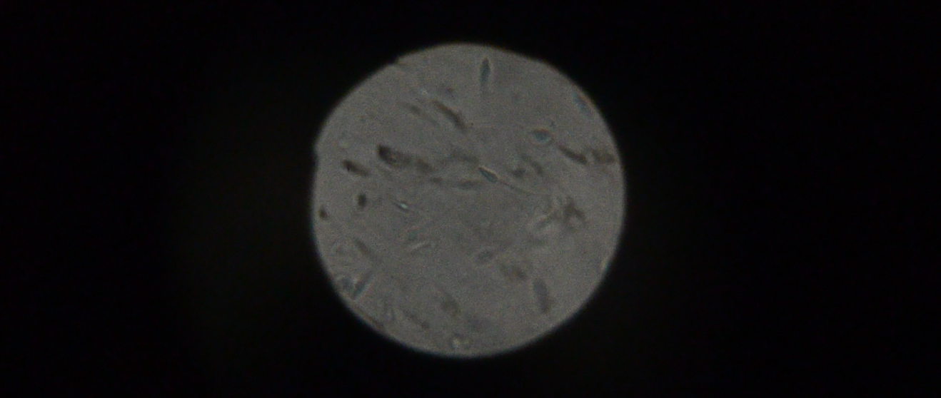 Two drops of the artists’ sperm dancing to Selena Gomez, seen by an audience through a microscope.